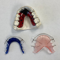 Different Types of Retainers