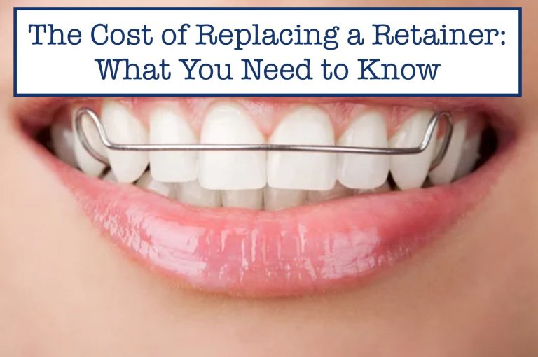 How Much Do Retainers Cost to Replace