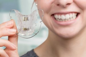 Invisalign Retainers After Treatment