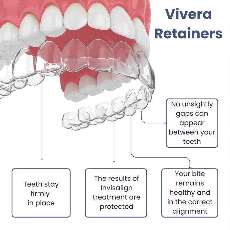 Invisalign Vivera Retainers