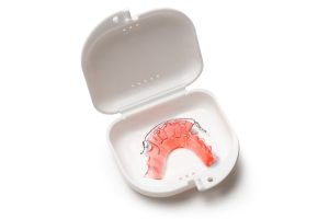 Retainer Kit at Home