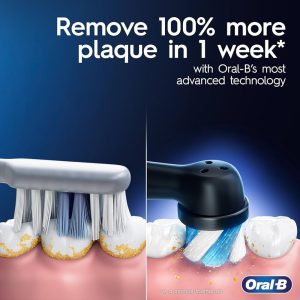 Io6 Oral B Review: Elevate Your Dental Care Game